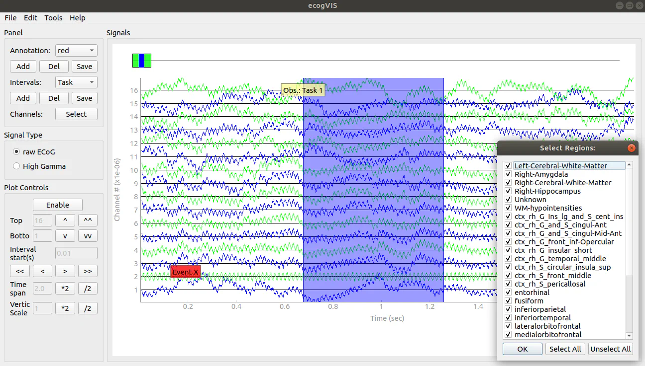 EcogVIS Screenshot